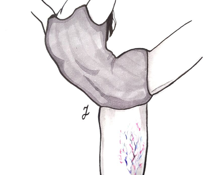 Pajączki na przyśrodkowej stronie uda 